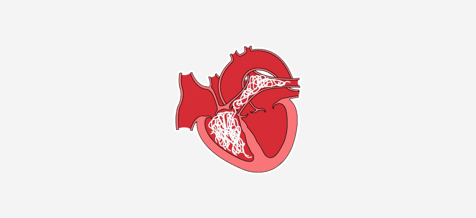 Srdeční dirofilarióza – srdeční červivost